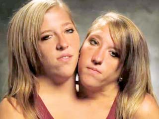 الشهرة تحلق بالفتاة ذات الرأسين